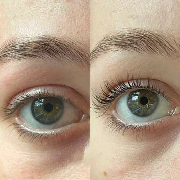 Lashextend™ - Wimpergroeiserum Voor Langere En Vollere Wimpers (50% Korting)