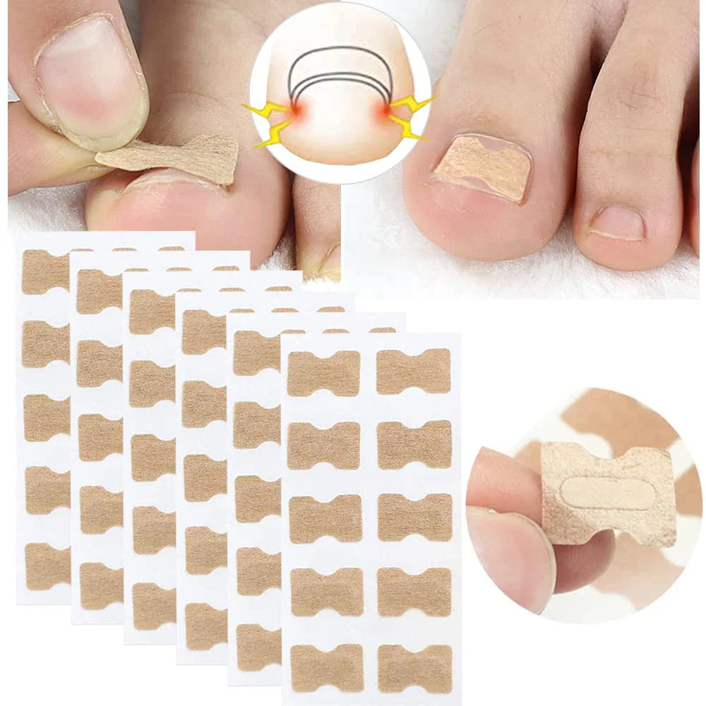 NailNurture™ - Nagelcorrectie verzorgingssticker (50% KORTING)