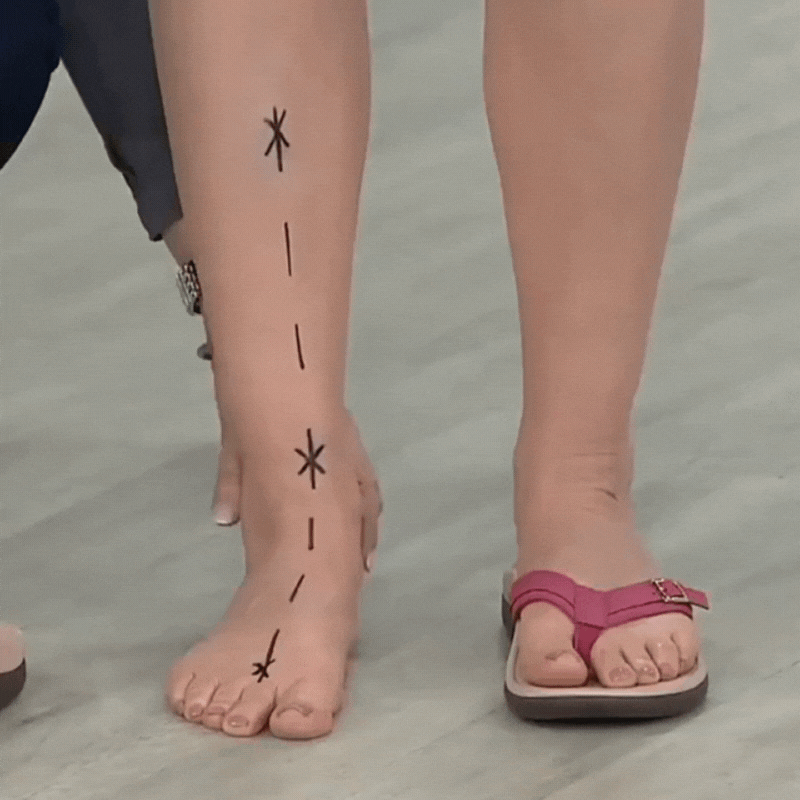 Modioza's™ - Orthopedische Zomersandalen (50% KORTING)