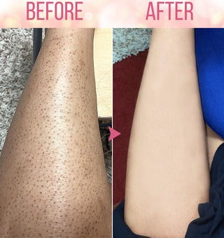 LuxeSilk™ - Ontharingsmousse