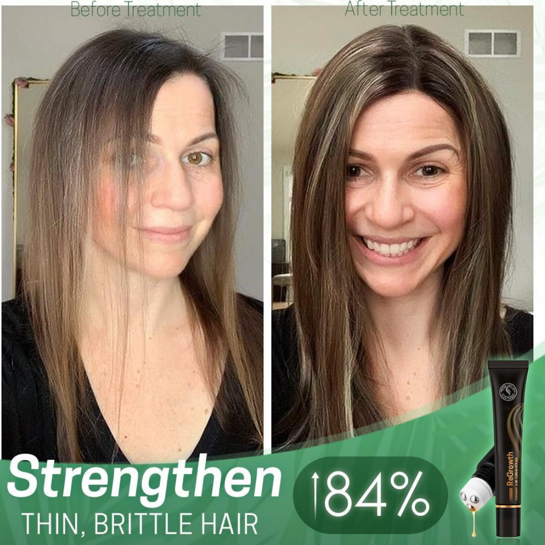 Regrow Haarserum™ | 1+1 GRATIS