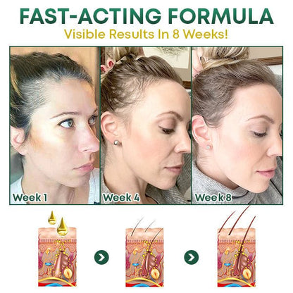 1+1 GRATIS | HairFix™ - Haarserum voor haargroei