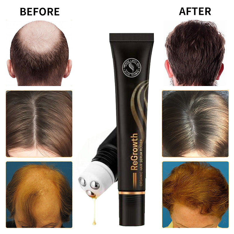 Regrow Haarserum™ | 1+1 GRATIS