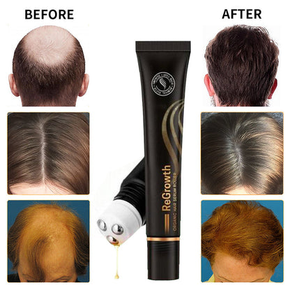 Regrow Haarserum™ | 1+1 GRATIS