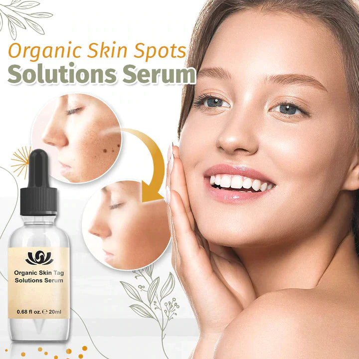 Natural Skin Tag Remover™  |Biologisch serum voor het verwijderen van huidvlekjes!