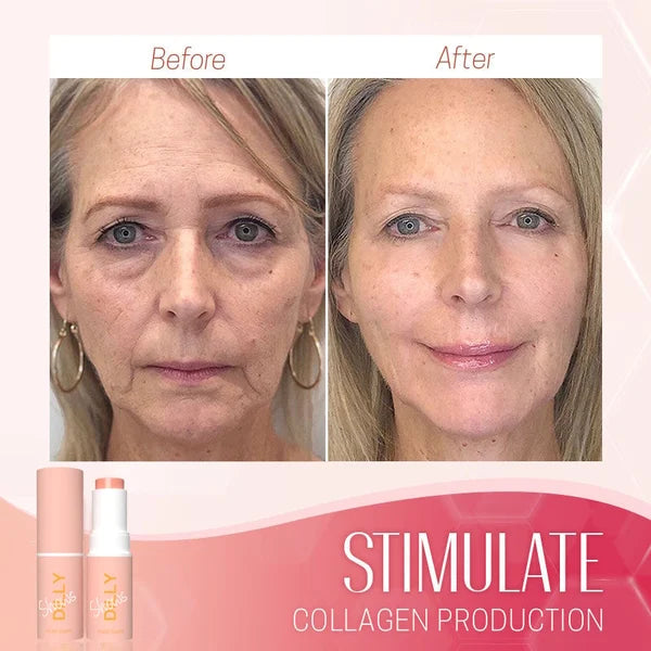 Derol Silky™ | Verwijder en voorkom rimpels [1+1 gratis!]