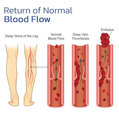 ReviveKnee™ Elite Support Kniebandage 1+1 GRATIS