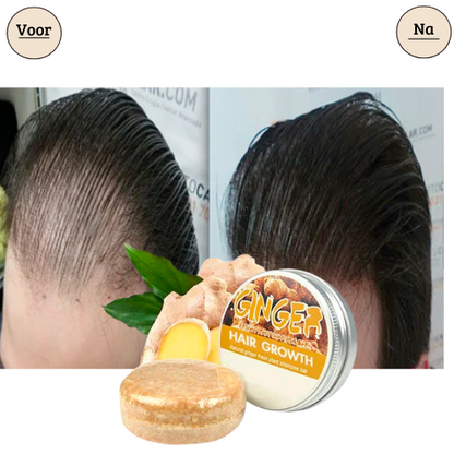 Supreme ReGrow™ | 1+1 Gratis! Zeg nee tegen haaruitval!