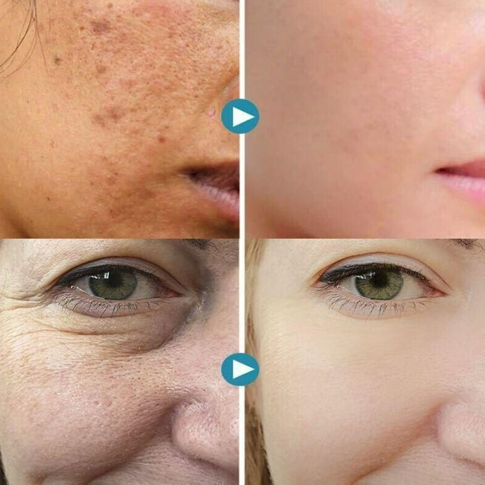 NewSkin™ Porie Onzichtbare Crème