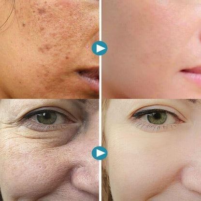 NewSkin™ Porie Onzichtbare Crème