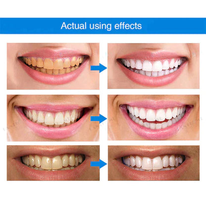 PureSmile™ Organic Teeth Whitening