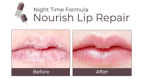 Derol™ - Lip Plumper Kit (50% KORTING)