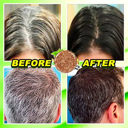 HerbCare™ Shampoo Bar | Krijg je kleur & levendigheid terug! Weg met grijze haren & haarverlies!
