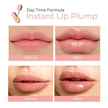 Derol™ - Lip Plumper Kit (50% KORTING)