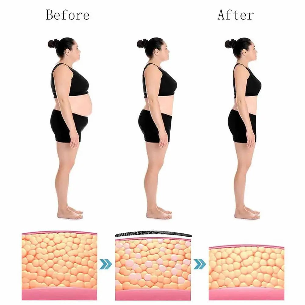 HeatRelief™ - Zelfverwarmende Kniebandage (50% KORTING)