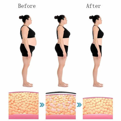 HeatRelief™ - Zelfverwarmende Kniebandage (50% KORTING)