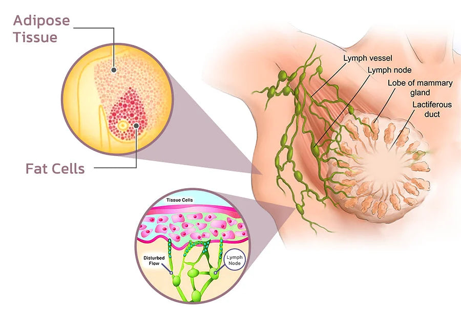 Marin™ | Comfortabele zachte bh voor senioren (VANDAAG 1+2 GRATIS)