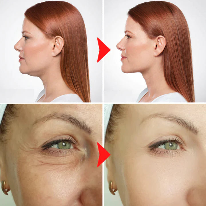 Facey™ | Krijg de huid die je altijd al wilde!