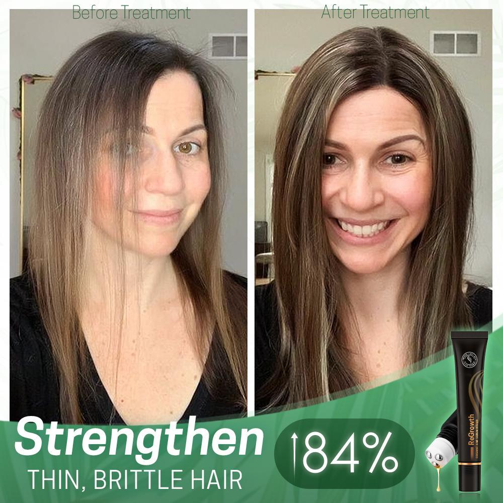 Regrowth™ Organic Haar Serum Roller